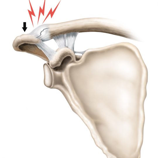 lesoes ligamentares